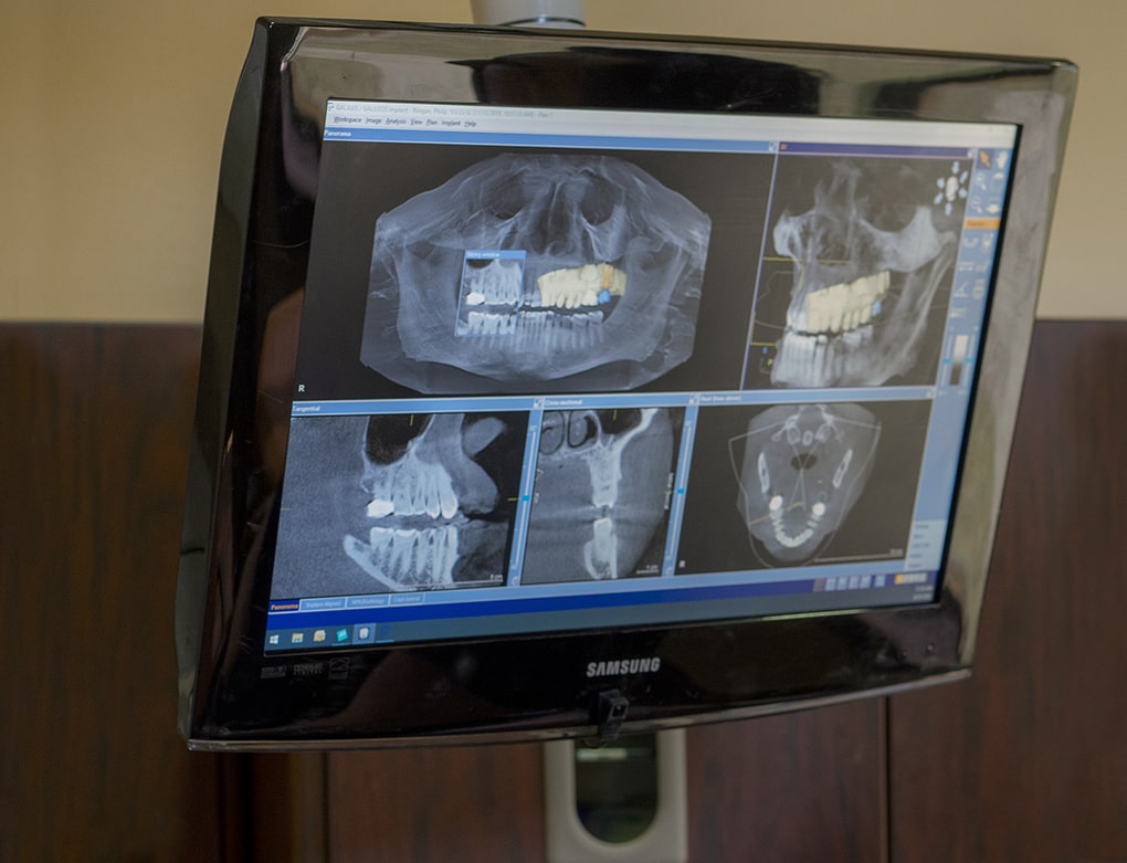 west side of Spring in the Champions Forest 